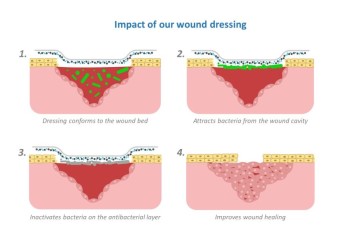 Nanordica Medical wound healing 1140x641