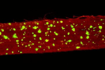 Skin cells grown into nanofiber scaffold 887x665