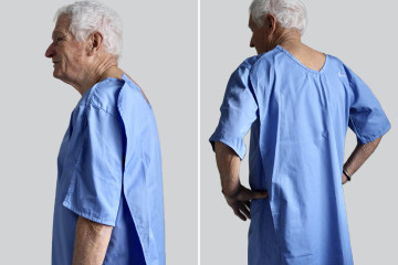 Inversus hospital gown 3